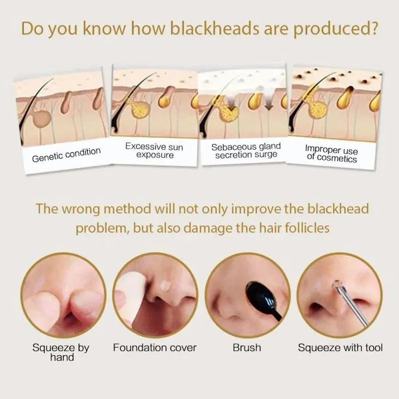 Blackhead Remover Nose Mask