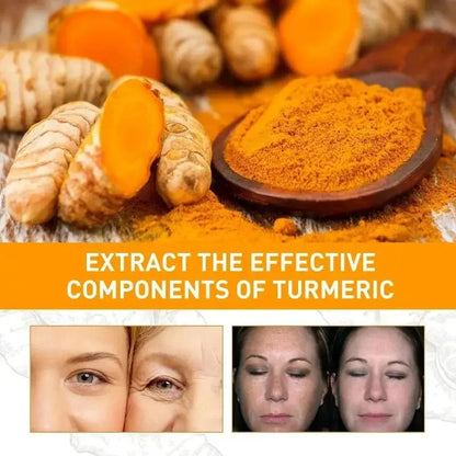 Turmeric Freckle Removal Cream