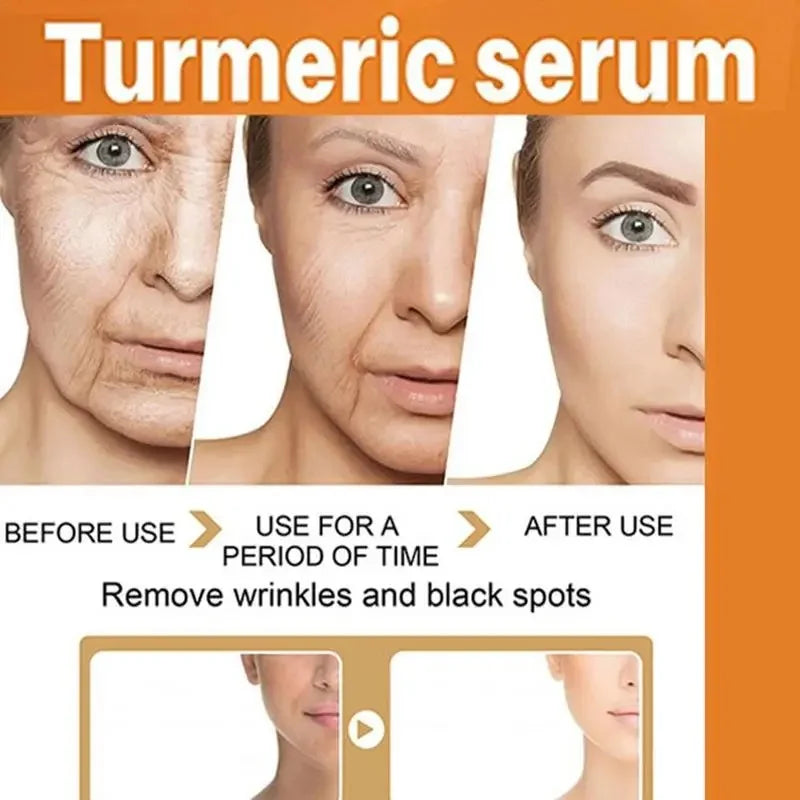 Turmeric Serum For Face And Body