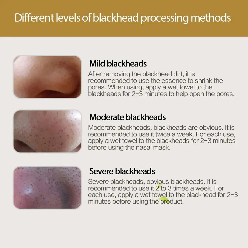 Blackhead Remover Nose Mask