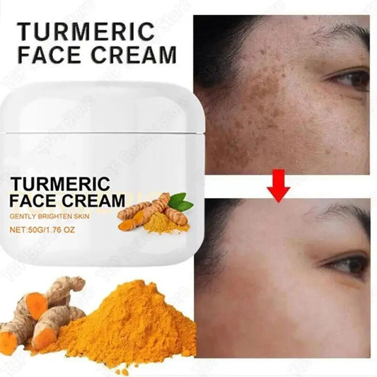 Turmeric Freckle Removal Cream